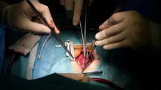 Un'operazione a cuore aperto