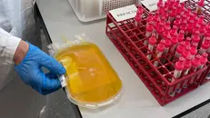 Cresce la raccolta di plasma in Lombardia