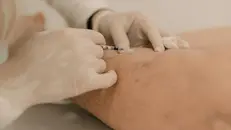 Infiltrazioni di ozono