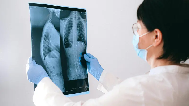 Una dottoressa studia una radiografia