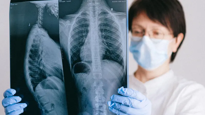 L'obiettivo è favorire la diagnosi precoce del tumore al polmone