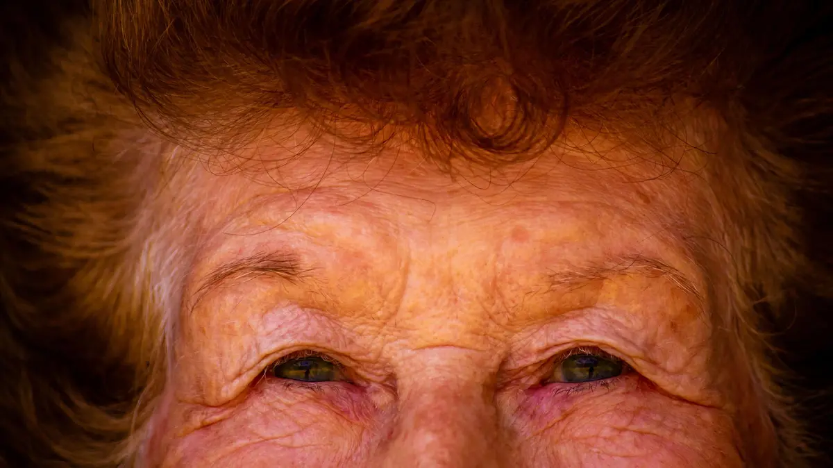 La malattia è più frequente dopo i 65 anni