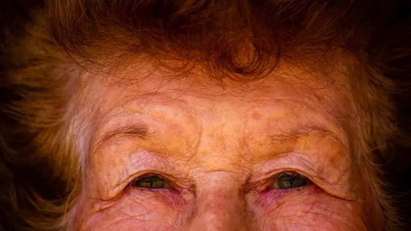 La malattia è più frequente dopo i 65 anni