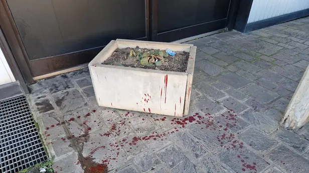 I segni dell'aggressione nel parcheggio