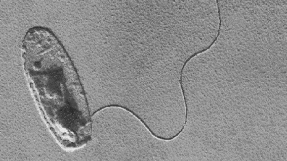 Il bacillo della legionella visto al microscopio
